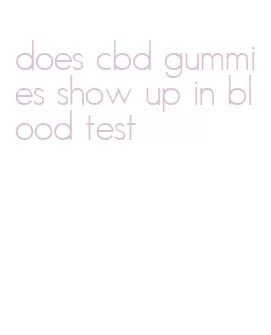 does cbd gummies show up in blood test